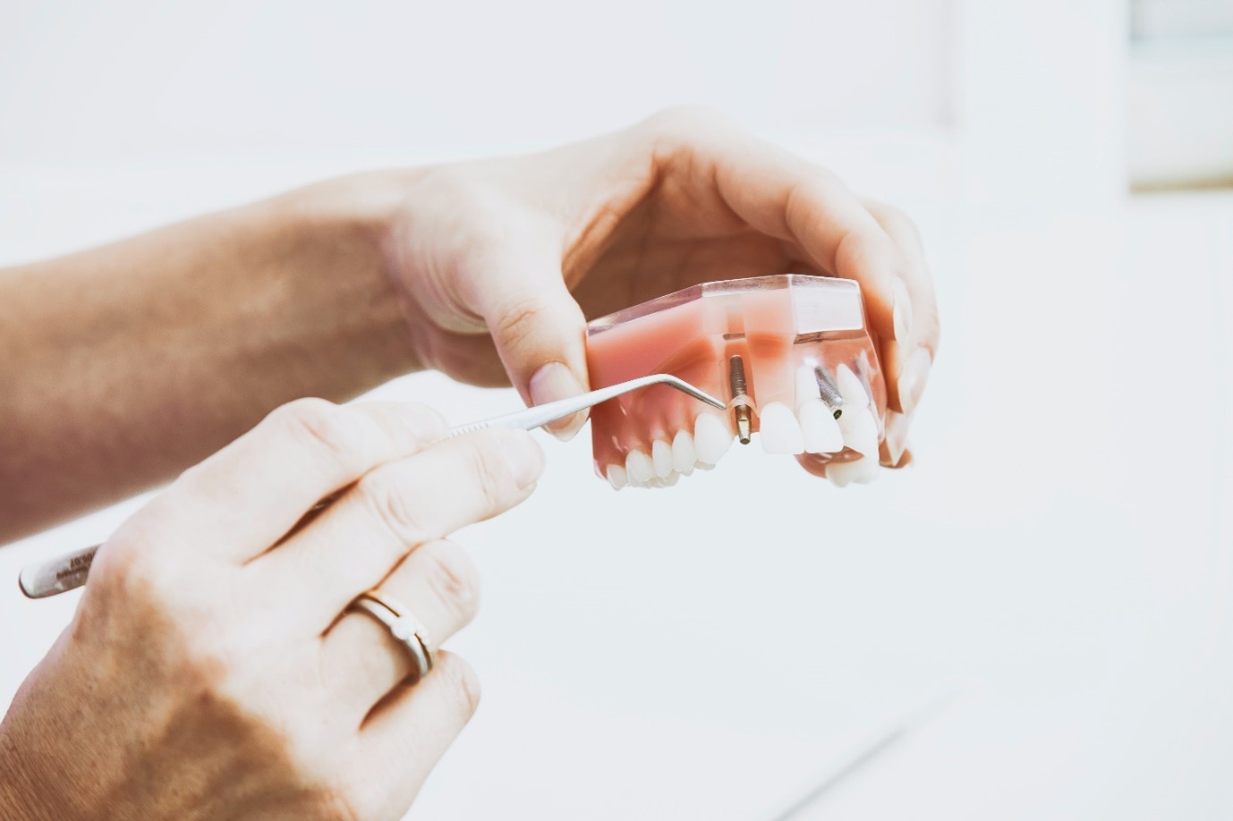 Want To See How Dental Implants Can Change Your Life? Read This!