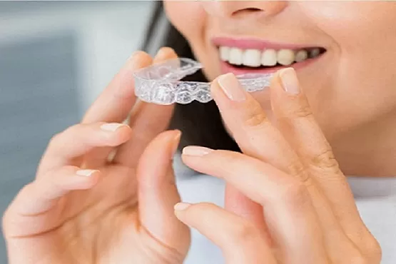 Invisalign: Your Complete Guide To Invisible Braces