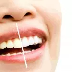 How to Achieve a Brighter Smile: The Ultimate Guide to Teeth Whitening