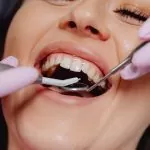 Non-Extraction Orthodontics / Airway Orthodontics