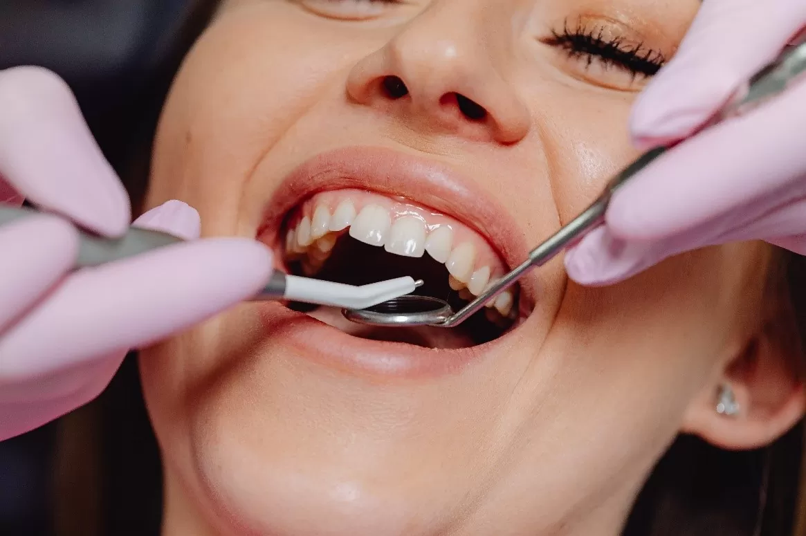 6 Things You Should Know Before Choosing an Implant Dentist
